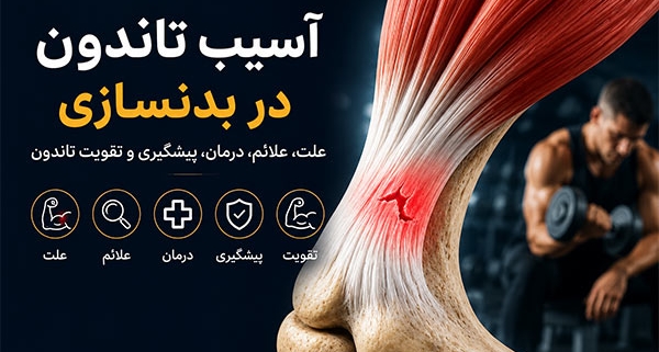 آسیب تاندون در بدنسازی؛ علت، علائم، درمان، پیشگیری و تقویت تاندون